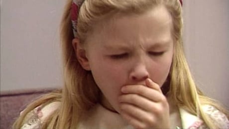 Whooping cough is the common name for the highly contagious bacterial disease pertussis. Symptoms include fever and severe coughing. mi-bc-120104-archive-whooping-cough