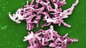 si-c-difficile-220-cp-cdc