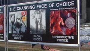 si-antiabortion