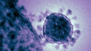 si-coronavirus-220-cp-03868