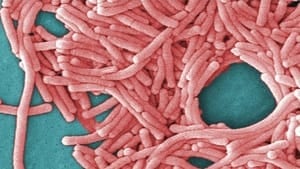 hi-legionella-legionnaires--4col