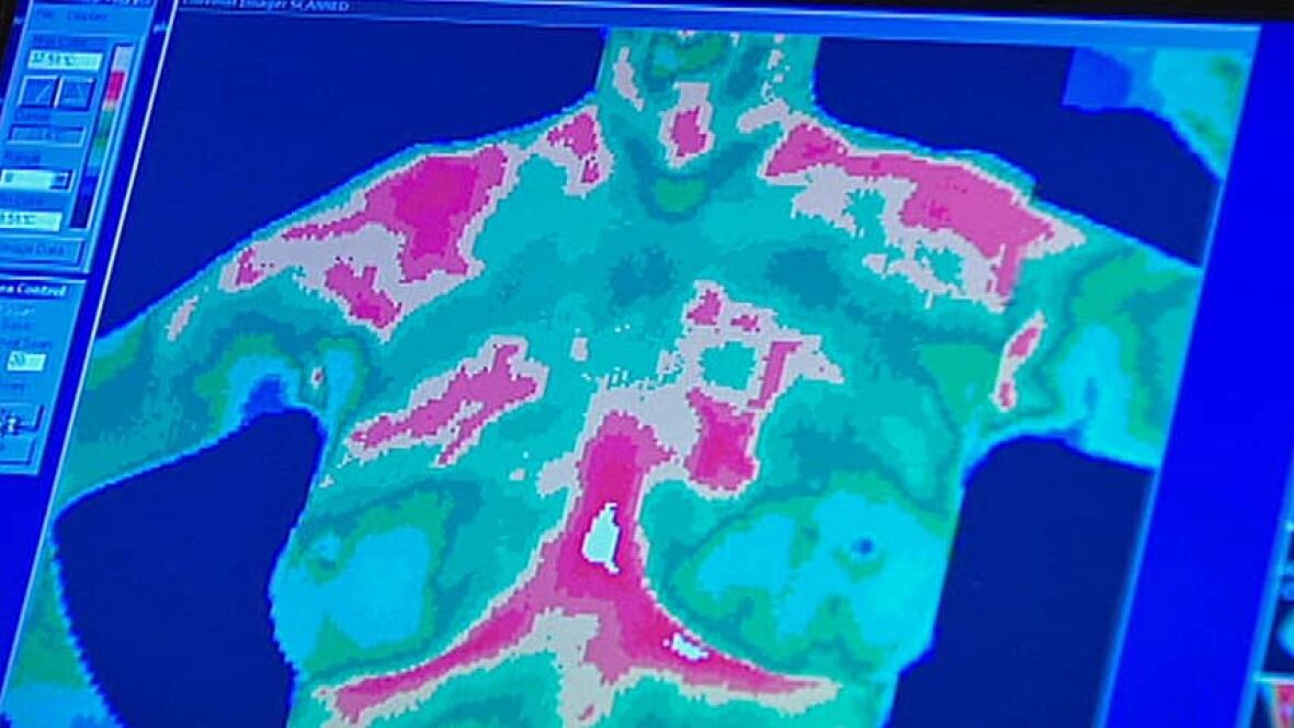 breast thermography toronto Orlando escort review