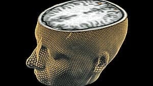 brain-scan-300-rtr1vi8y