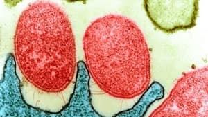 mi-hpylori-getty117451580