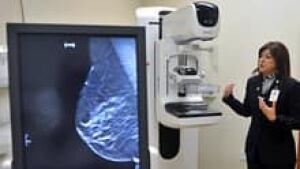 si-mammogram-breast-220-cp-