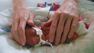 si-bc-120326-australian-baby-premature