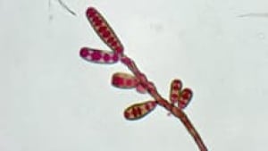 si-meningitis-fungal-cdc-cp