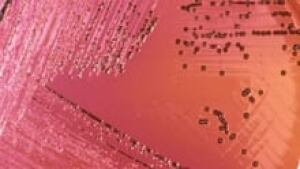 hi-salmonnella-3col