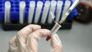 si-blood-test-220-cp-rtxald