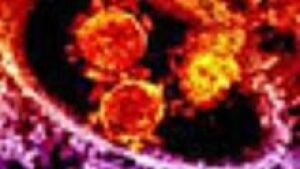 si-coronavirus-852-red-niai