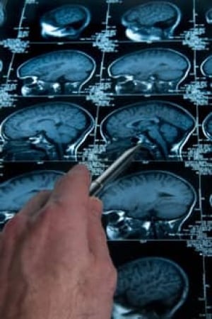 si-brain-scan-220-istock