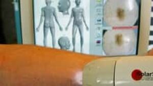 si-skin-cancer-220-cp-rtxl8