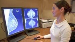 si-breast-cancer-220-cp-is