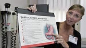 si-gastric-bypass-220-cp-31