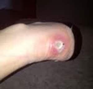 si-spainjury2