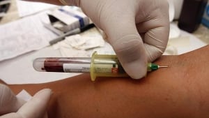 hi-blood-test-852-cp-894077