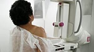 si-mammogram-breast-220-cp-