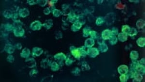 si-amoeba-naegleria-fowleri