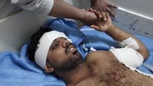 mi-iraq-wounded-rtx10plr