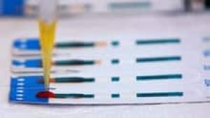 hi-bc-121130-hiv-aids-test-3col