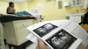 si-ultrasound-pregnancy-220