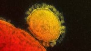 si-mers-coronavirus-220-cp-