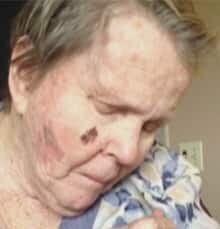 si-bc-130708-abbotsford-alzheimers-feeding-bentley-1