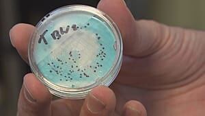 300-bacteria-culture