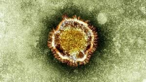 hi-sars-coronavirus-852-4col