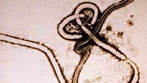 hi-ebola-virus