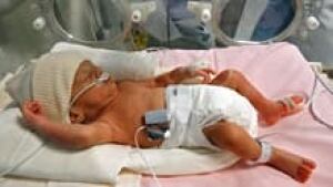 si-premature-baby-220-cp-38
