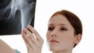 si-hip-xray-220-cp-is