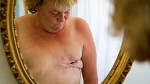 ii-burkitt-mirror-300