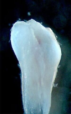 sm-250-tooth-from-urine-cell-regeneration
