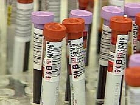 Official language rules block immigrants from donating blood, stem