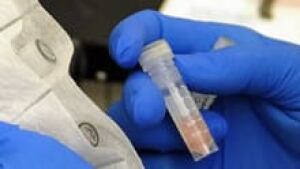 si-meningitis-fungal-220-cp