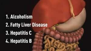 hi-bc-121224-liver-disease-causes-graphic-4col