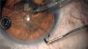 nb-tarek-youssef-eye-surger