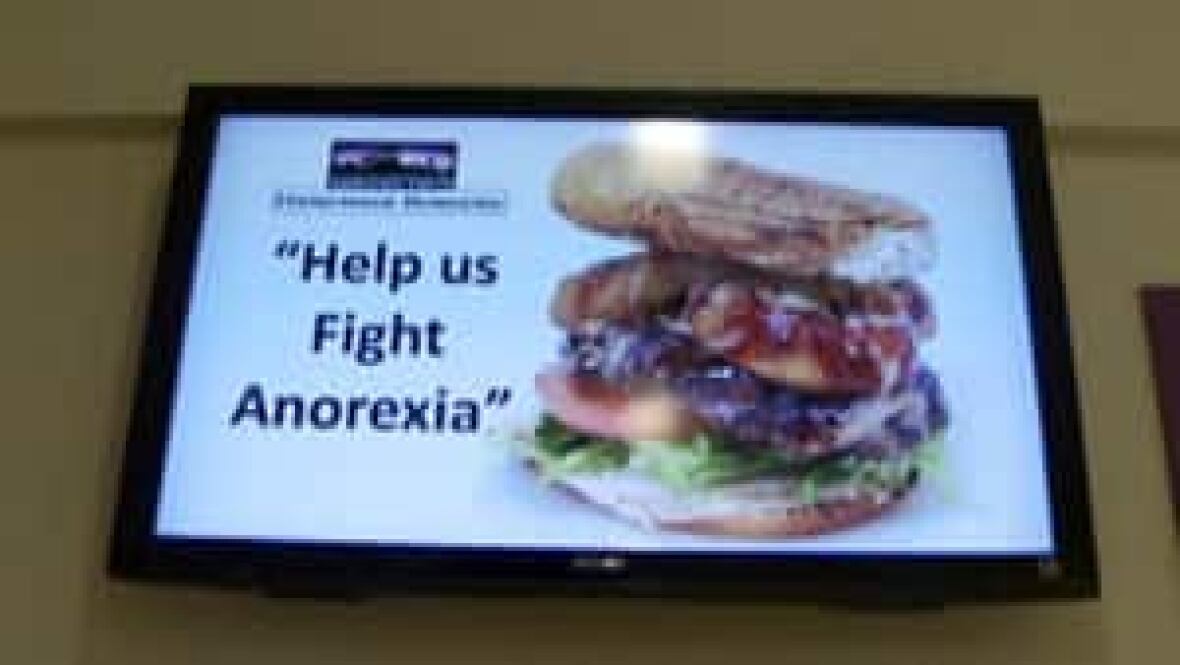 Stages of dying from anorexia picture