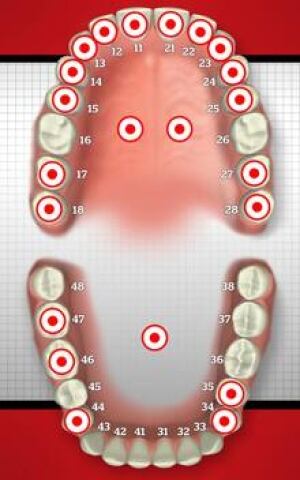 si-tooth-chart