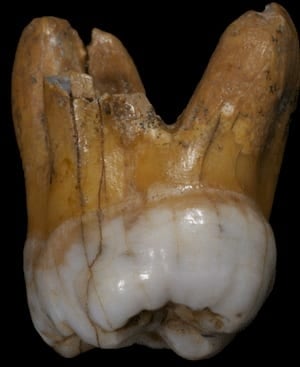 si-denisovan-tooth