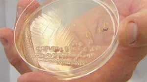 mi-bc-20110710-mrsa-culture