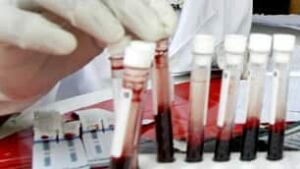 tp-blood-sample-cp-337431