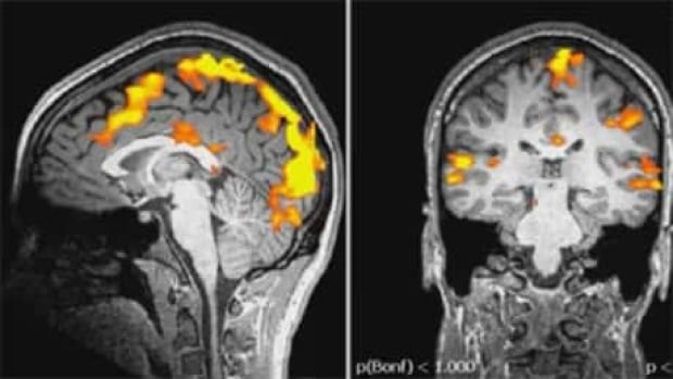 fi-460-fmri