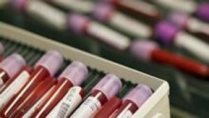 si-blood-test-tubes-220-cp-
