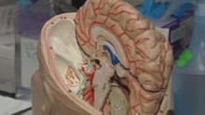 si-cgy-brain