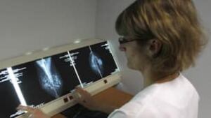 tp-mammogram-cp-RTR1Z2TF