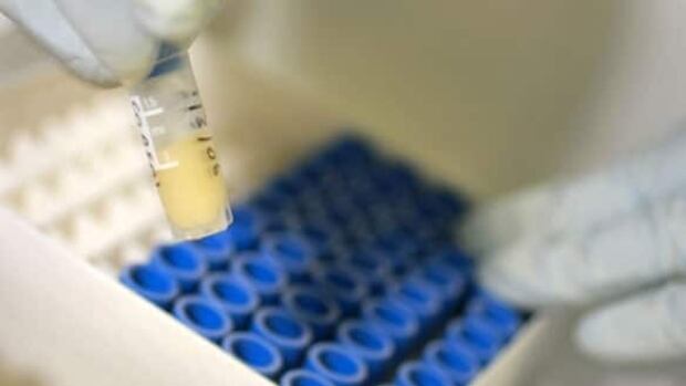 hiv-research-cp-RTR1S4JE
