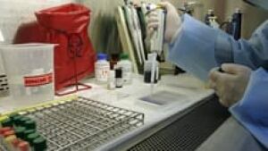 si-hiv-vaccine-220-cp-73815