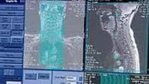 mi-bc-archive-ct-scan-image
